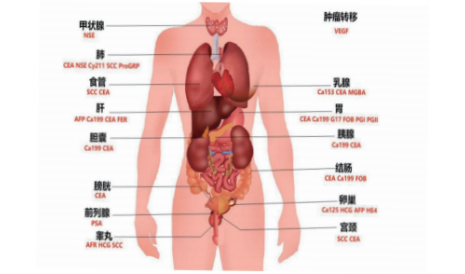腫瘤標(biāo)志物檢測(cè)全系列原料 -- 胃泌素釋放肽前體(Pro-GRP) 技術(shù)專(zhuān)題